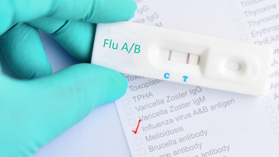 4 สายพันธุ์ไข้หวัดใหญ่